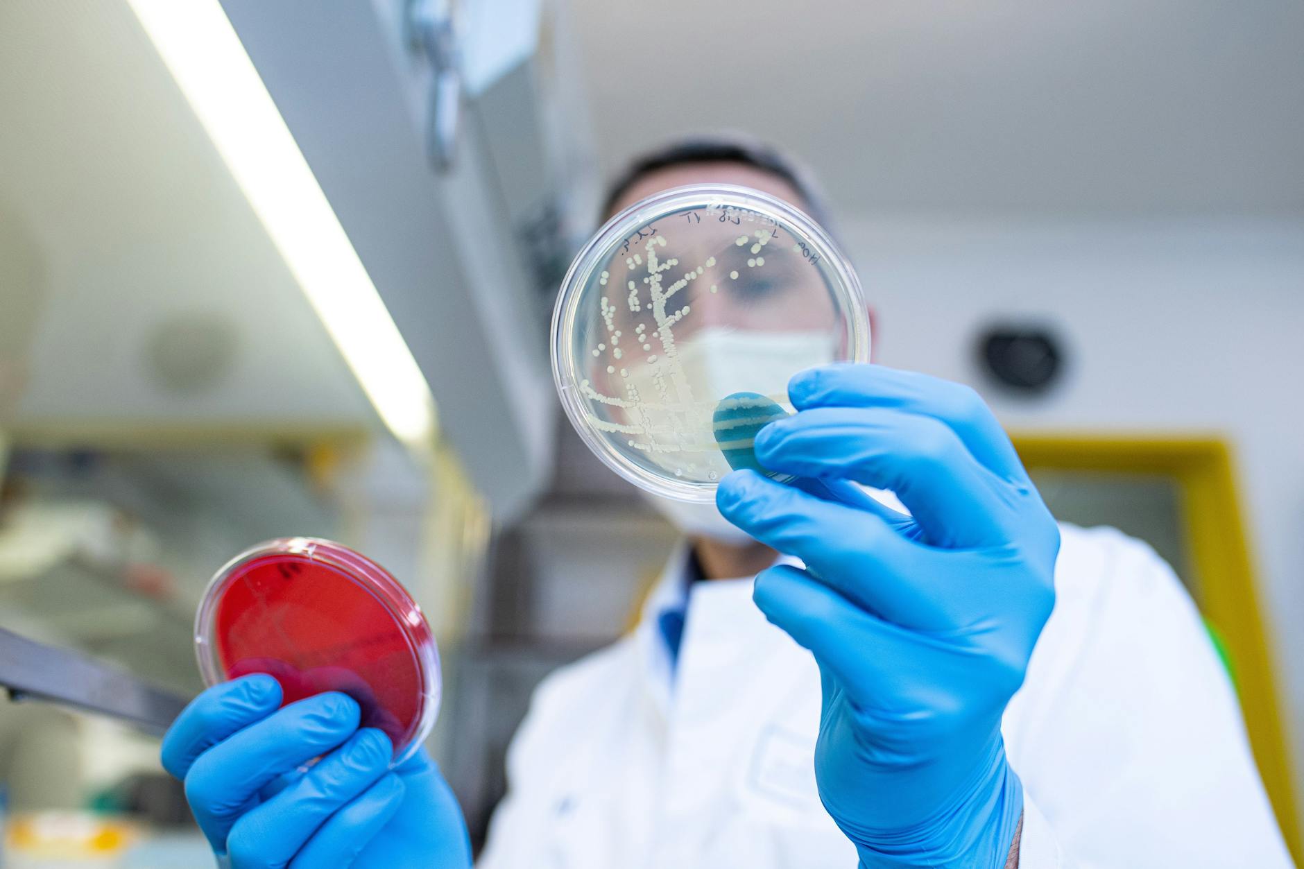 Prof. Alexander Mellmann, EHEC-Experte, Facharzt für Mikrobiologe und Hygiene am Universitätsklinikum Münster untersucht Proben verschiedener Keime, die auf Petrischalen kultiviert werden. (Archivbild)