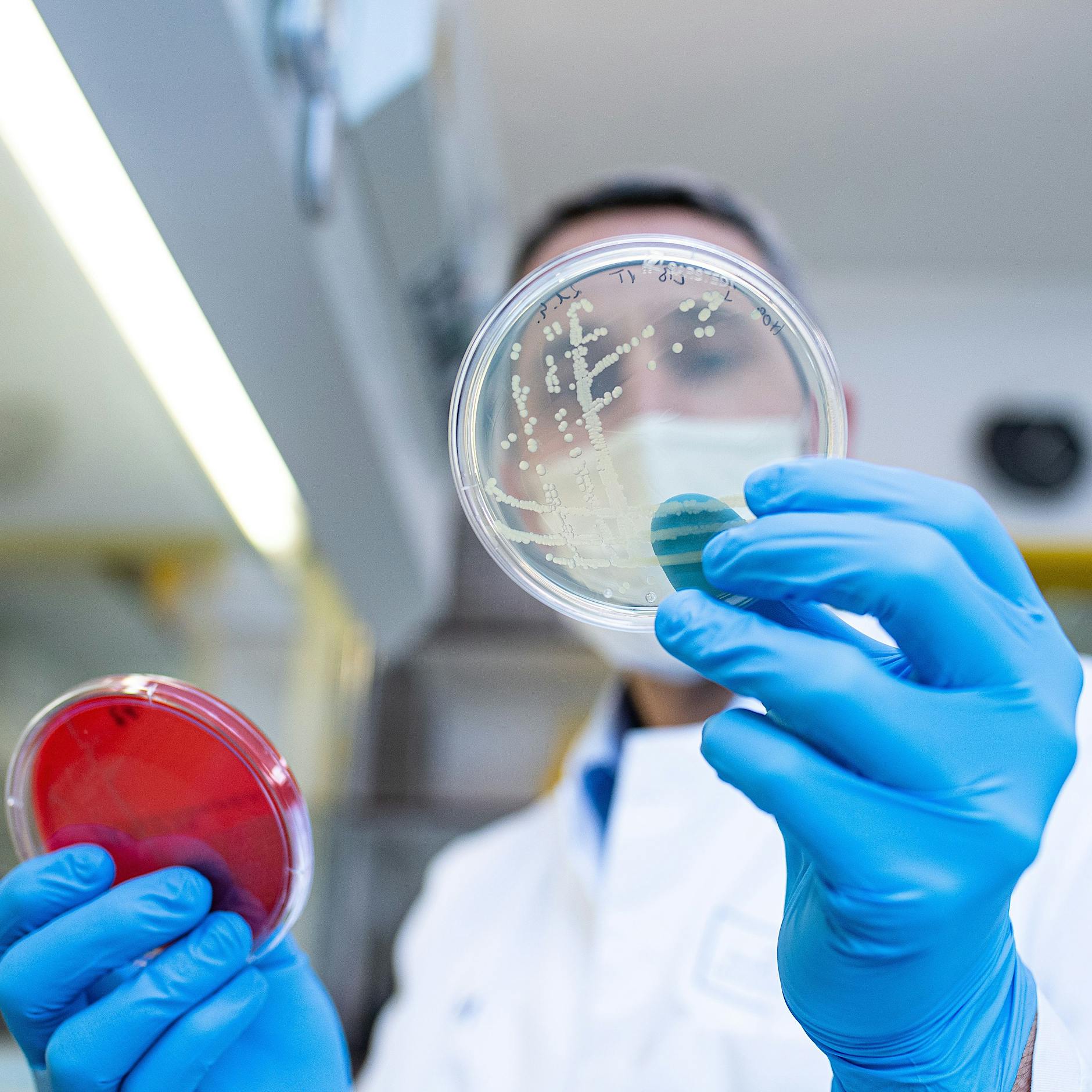 EHEC: Deutlicher Anstieg von Fällen der Darmkrankheit in Berlin