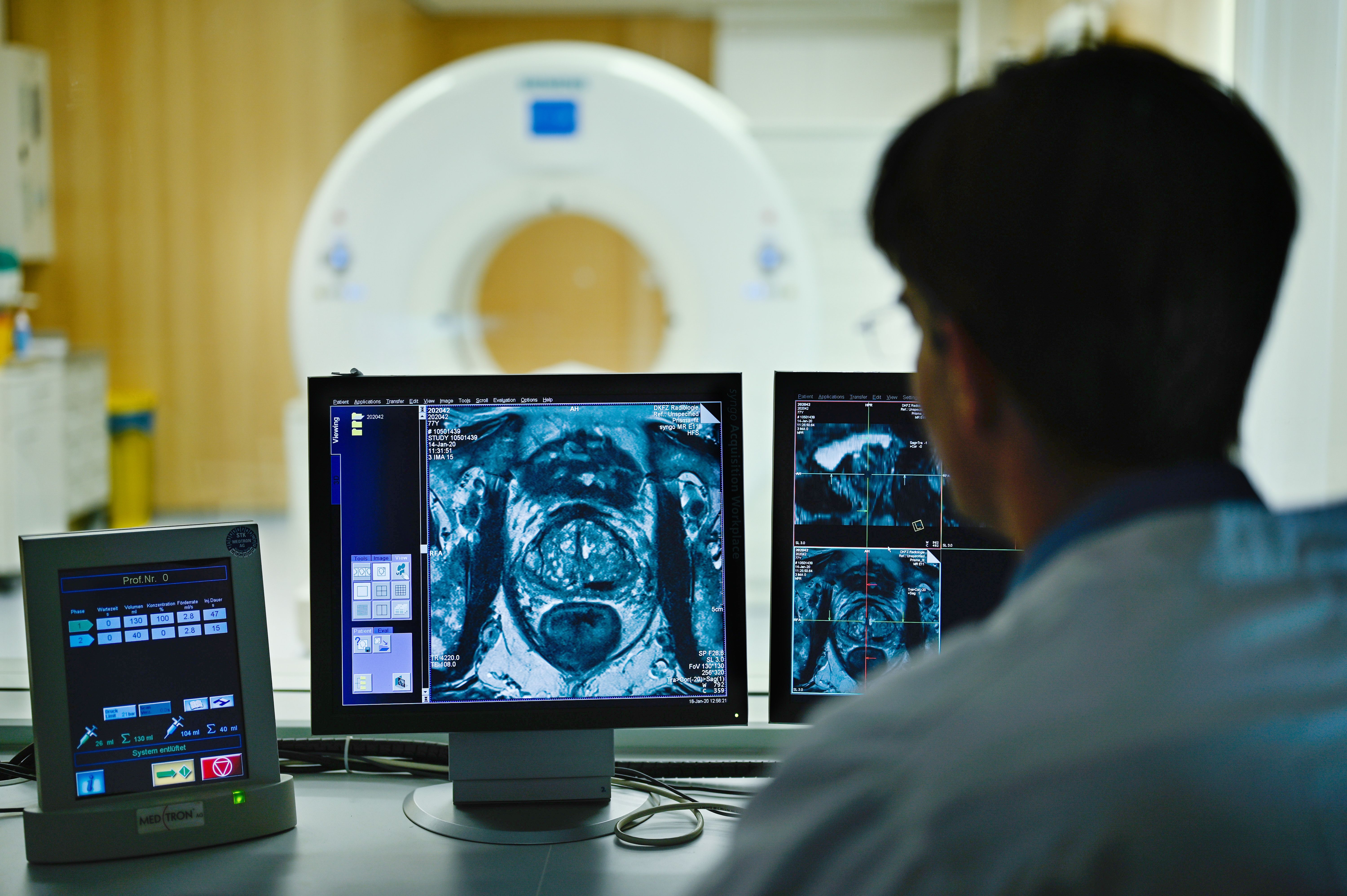 Krebs: Ist Berlin die Hauptstadt der Vorsorge-Muffel?