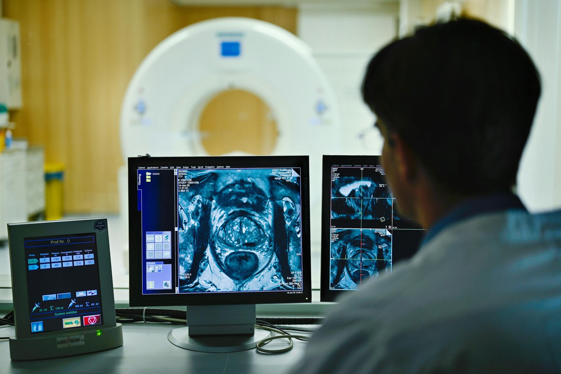 <strong>Ein Mitarbeiter betrachtet in einem Kontrollraum des Deutschen Krebsforschungszentrum (DKFZ) auf einem Monitor das Querschnittsbild einer Prostata.</strong>