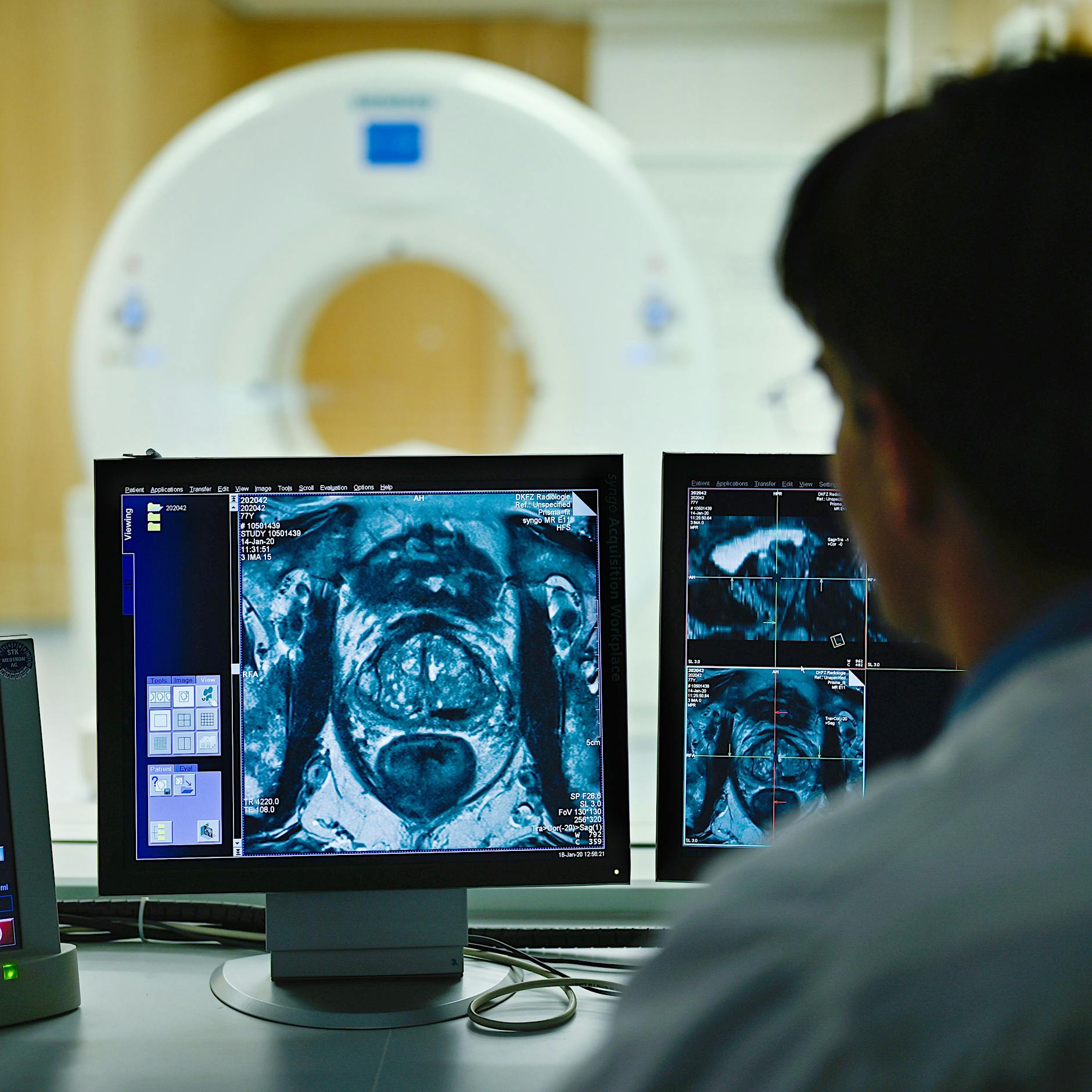 Krebs: Ist Berlin die Hauptstadt der Vorsorge-Muffel?