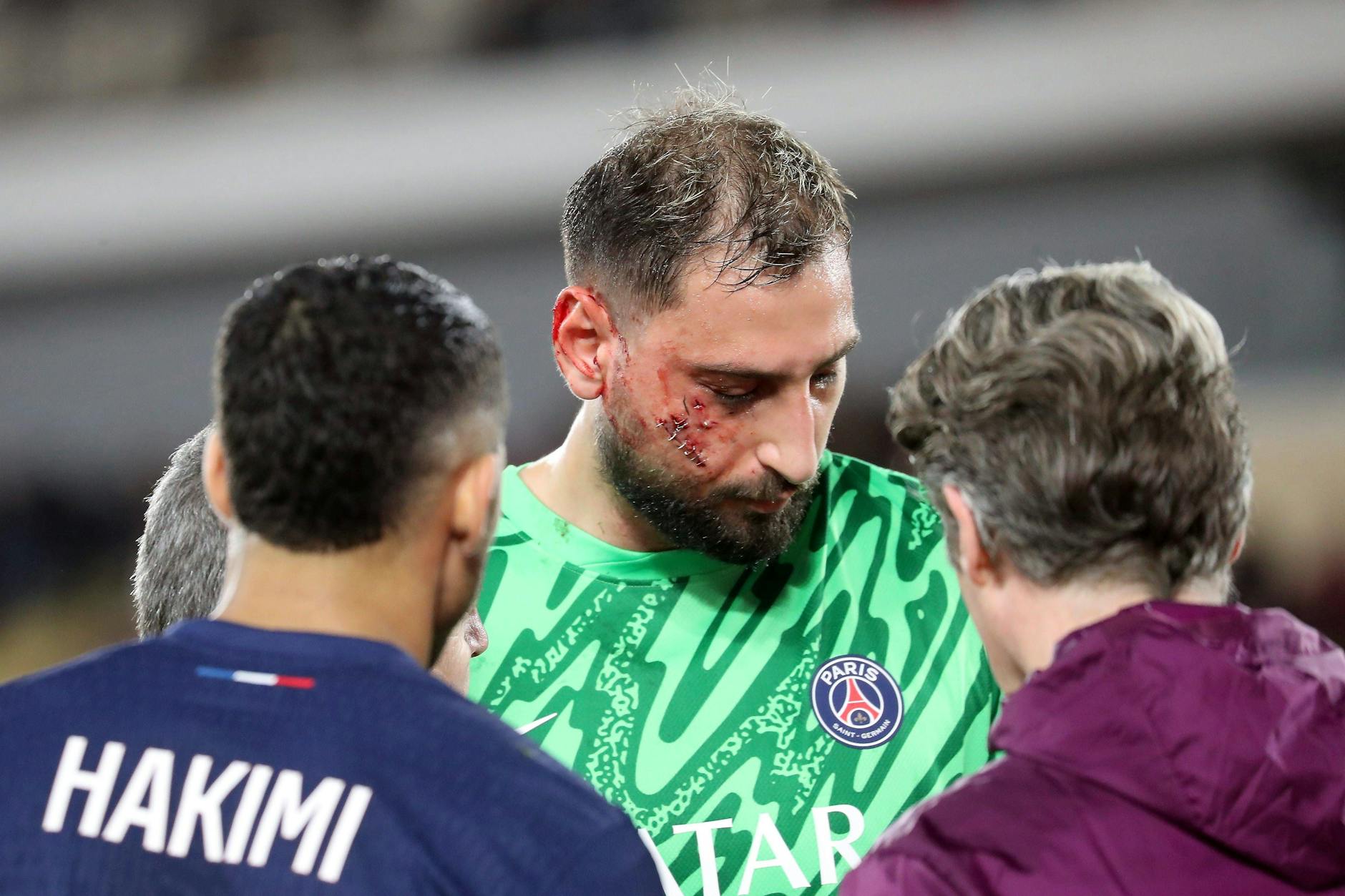 Itlaines Torwart Gianluigi Donnarumma taumelt benommen neben dem Platz. Die Ärzte hatten wegen klaffender Schnittwunden seine Wange mit Metallklammern zusammengeheftet.