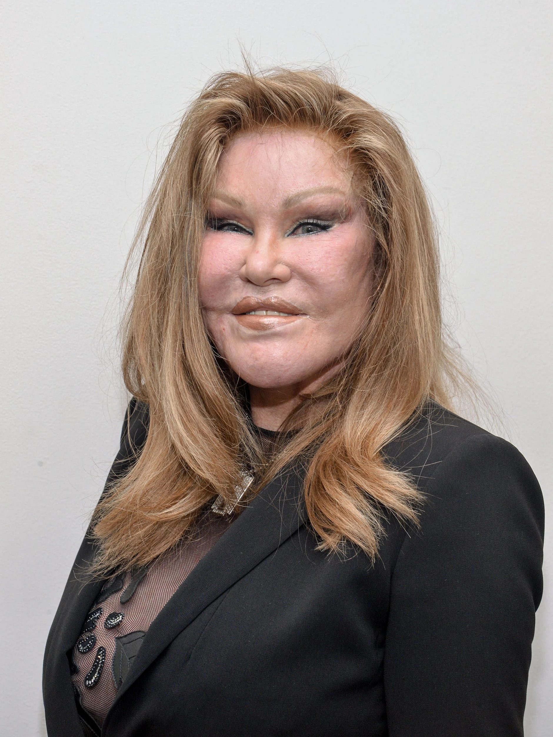 Jocelyn Wildenstein im Jahr 2015: Plastische Chirurgie sollte ihr ein katzengleiches Gesicht verleihen. Das Ergebnis dürften wohl die wenigsten als ästhetisch gelungen wahrnehmen.