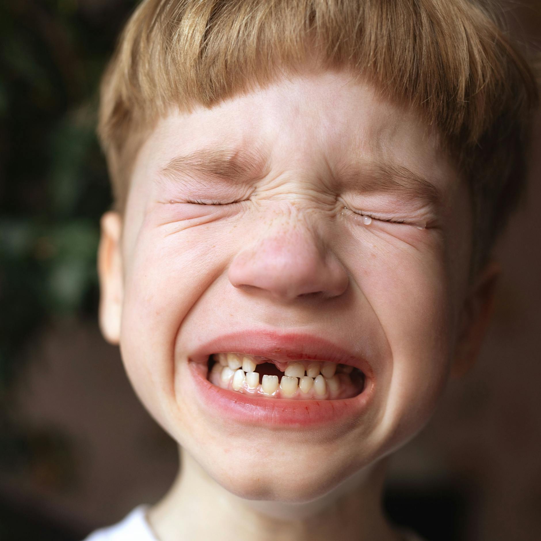 Nicht ins Taschentuch! Zahn rausgebrochen, was tun?