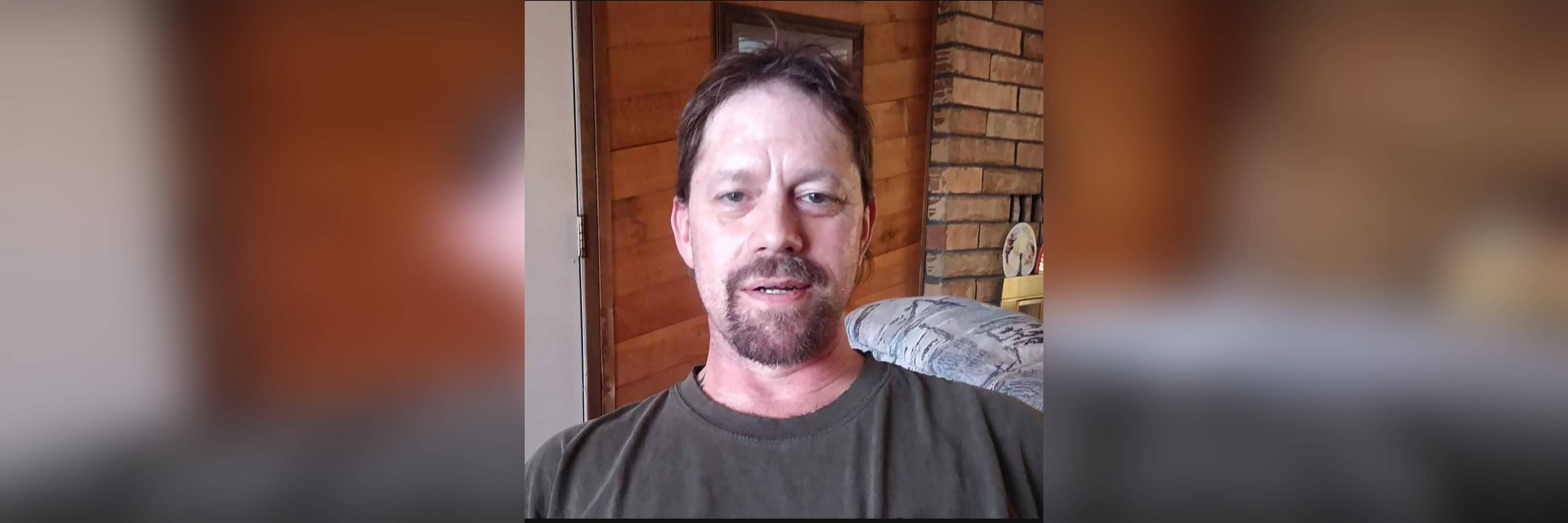 Image - Patient erwachte aus Narkose – weil sein Gesicht in Flammen stand