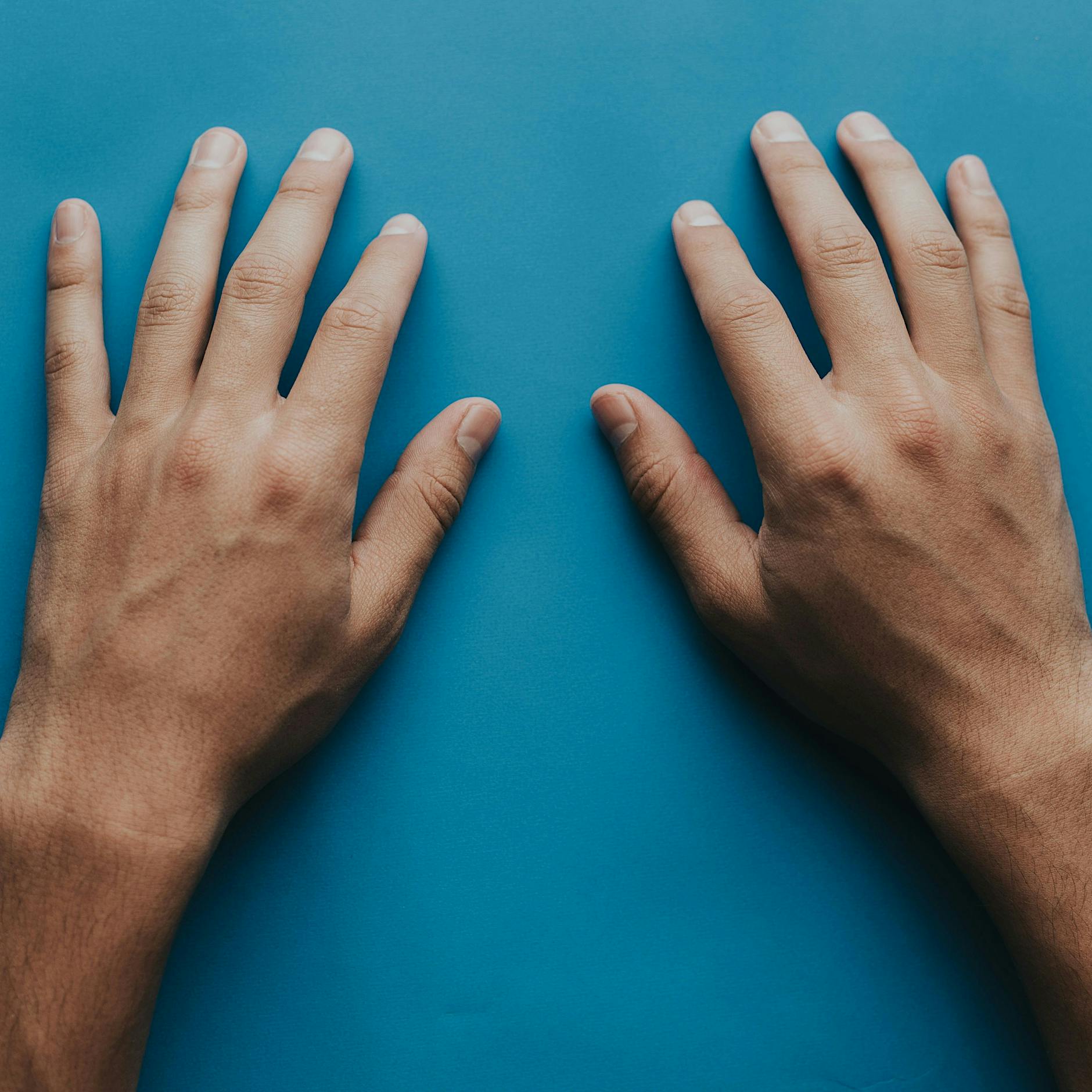 Durchblutungsstörungen: So warnt uns die Haut vor