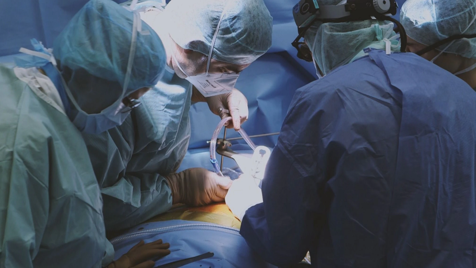 Bei einer Operation setzen Ärzte ein Herzpflaster ein.