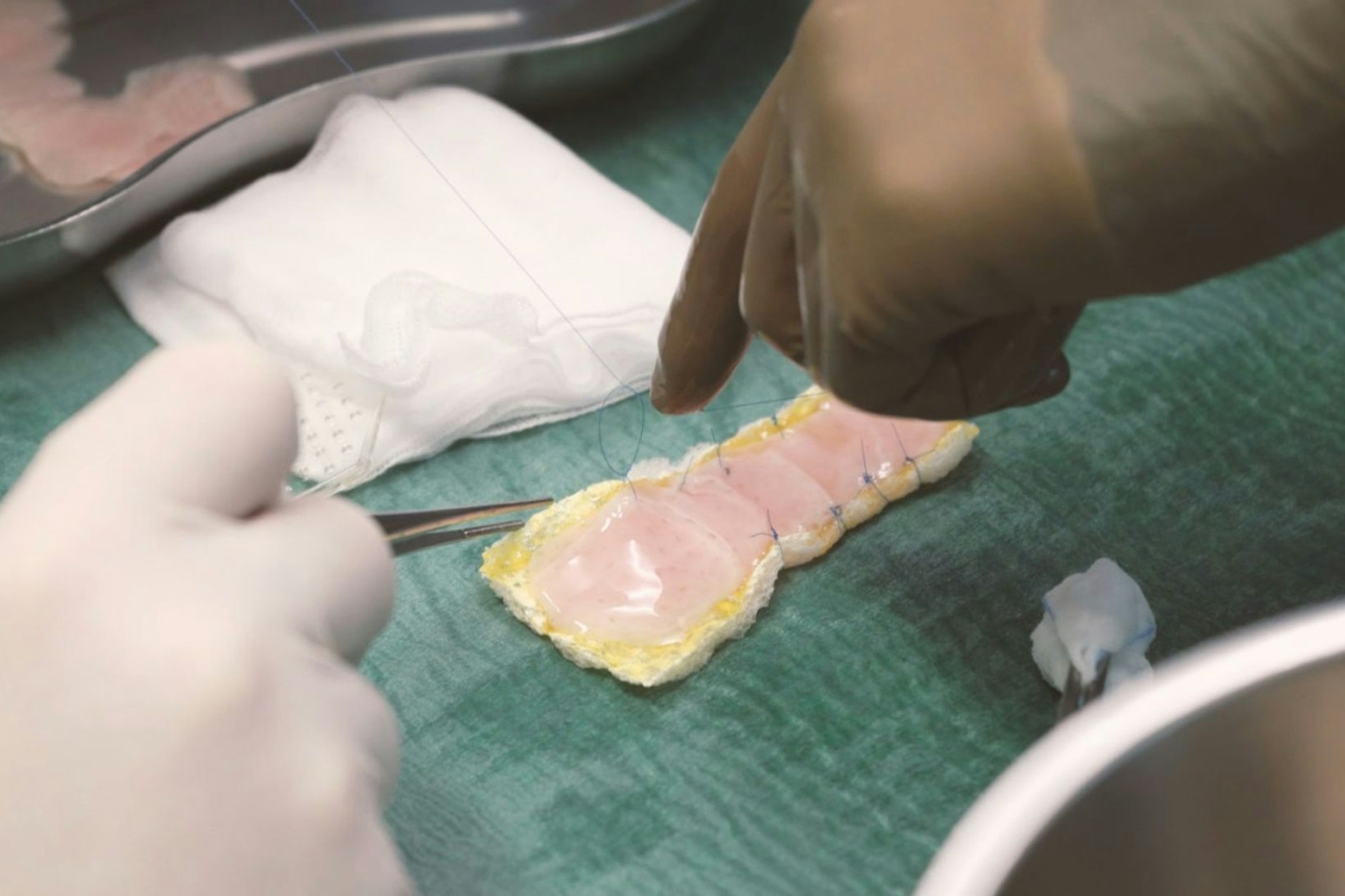 Ein aus Stammzellen gezüchtetes „Herzpflaster“ kann offenbar Menschen mit einer schweren Herzschwäche helfen.