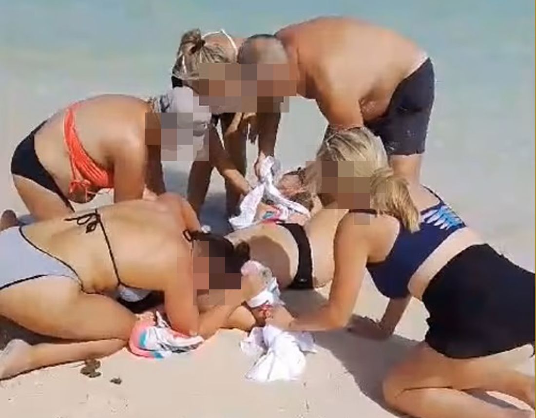 Image - Horror im Urlaub: Hai im Blutrausch beißt Frau (55) beide Hände ab!