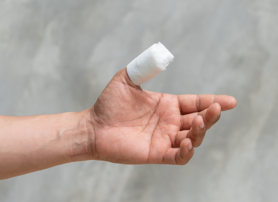 Mann (40) verbrennt sich den Daumen – und verliert beide Beine