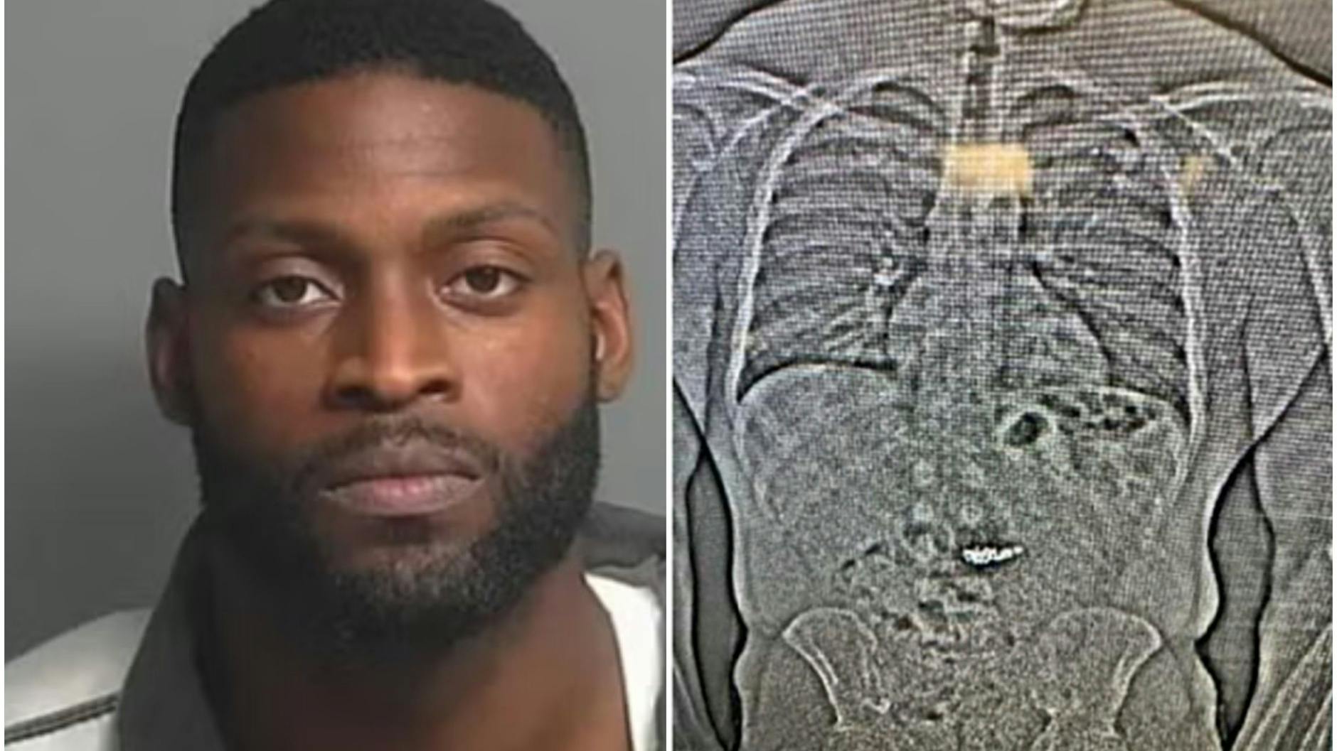 Jaythan Gilder soll Ohrringe im Wert von 769.500 Dollar gestohlen und später verschluckt haben. Auf der Röntgenaufnahme soll der Schmuck im Bauch zu sehen sein.