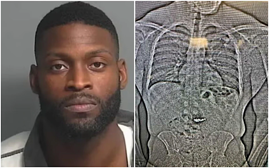 Die Polizei von Orlando veröffentlichte das Röntgenbild des mutmaßlichen Diebes. Es zeigt wahrscheinlich Ohrringe, die der Verdächtige geklaut und verschluckt hat.