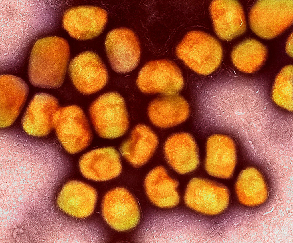 Beim Sex übertragen: Zahl der Mpox-Fälle in Berlin steigt wieder sprunghaft an