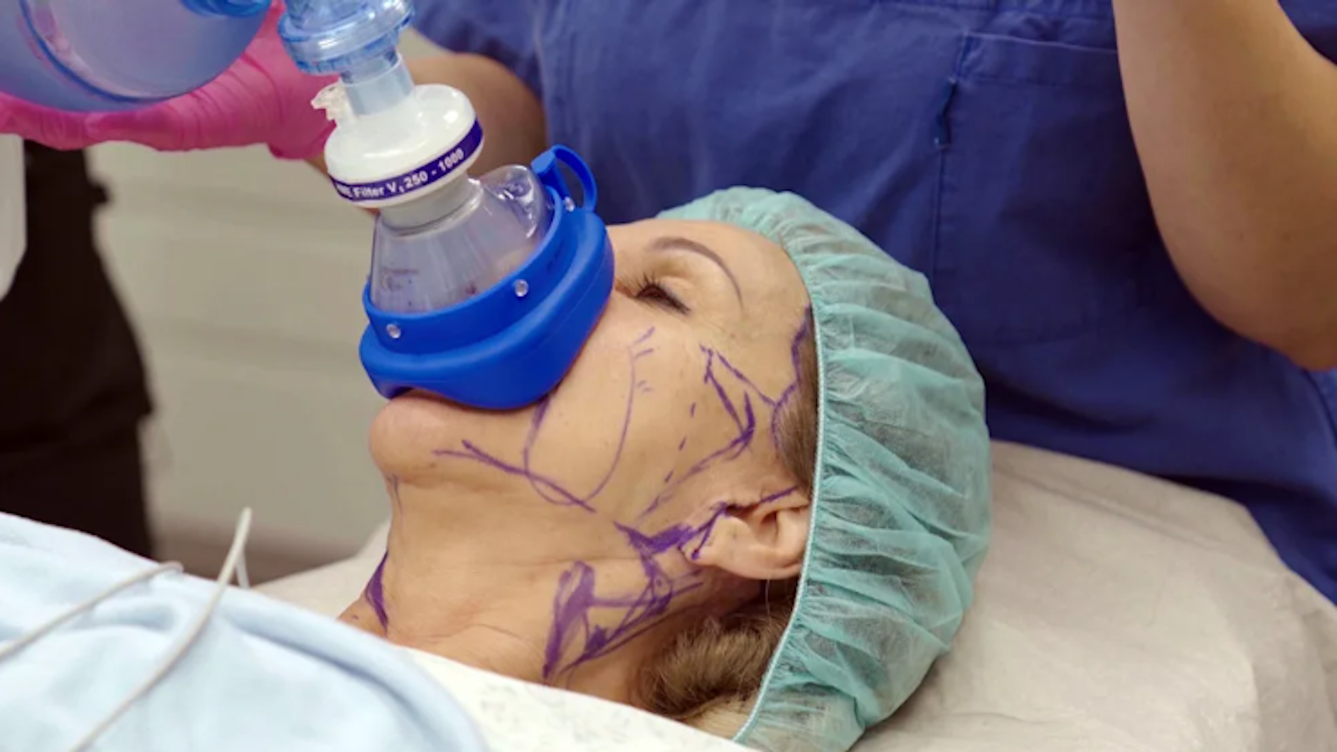 Ihre Schönheits-OP für ein strafferes Gesicht ließ Carmen Geiss von TV-Kameras begleiten.