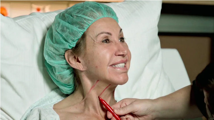 Carmen Geiss: So viel kostete ihre achtstündige Mega-Schönheits-OP