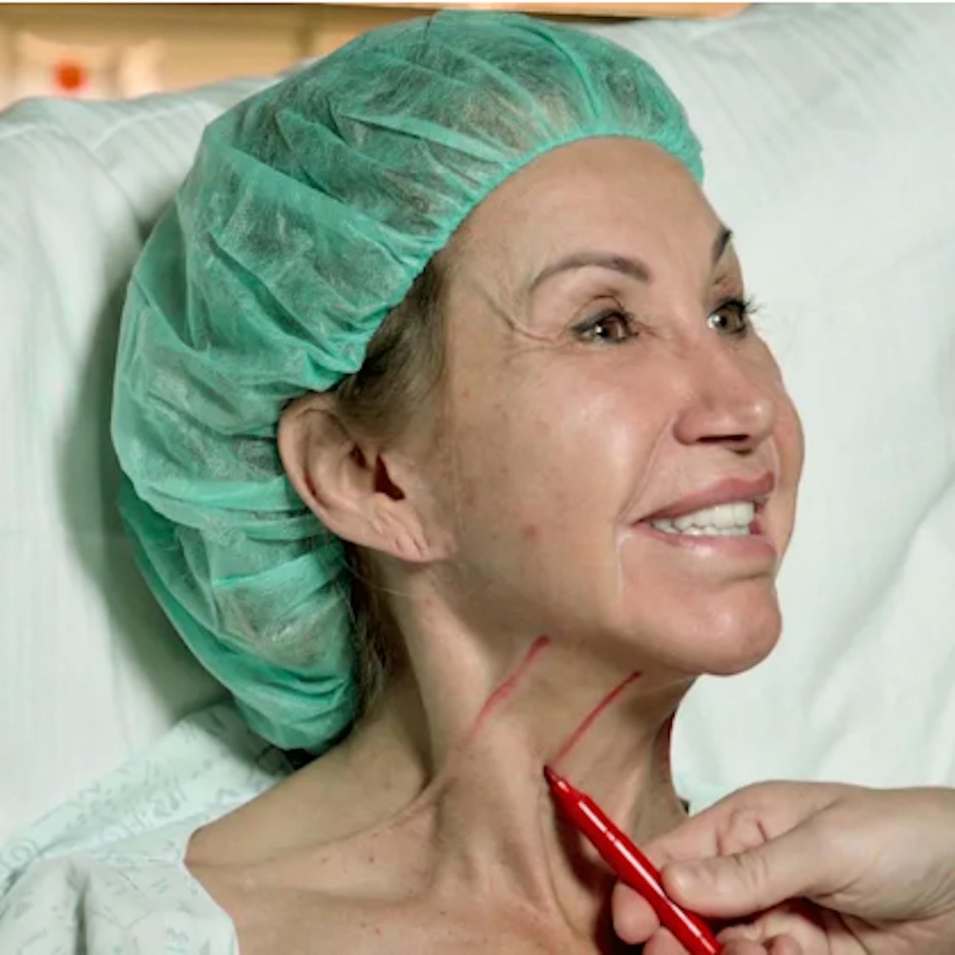 Carmen Geiss: So viel kostete ihre achtstündige Mega-Schönheits-OP