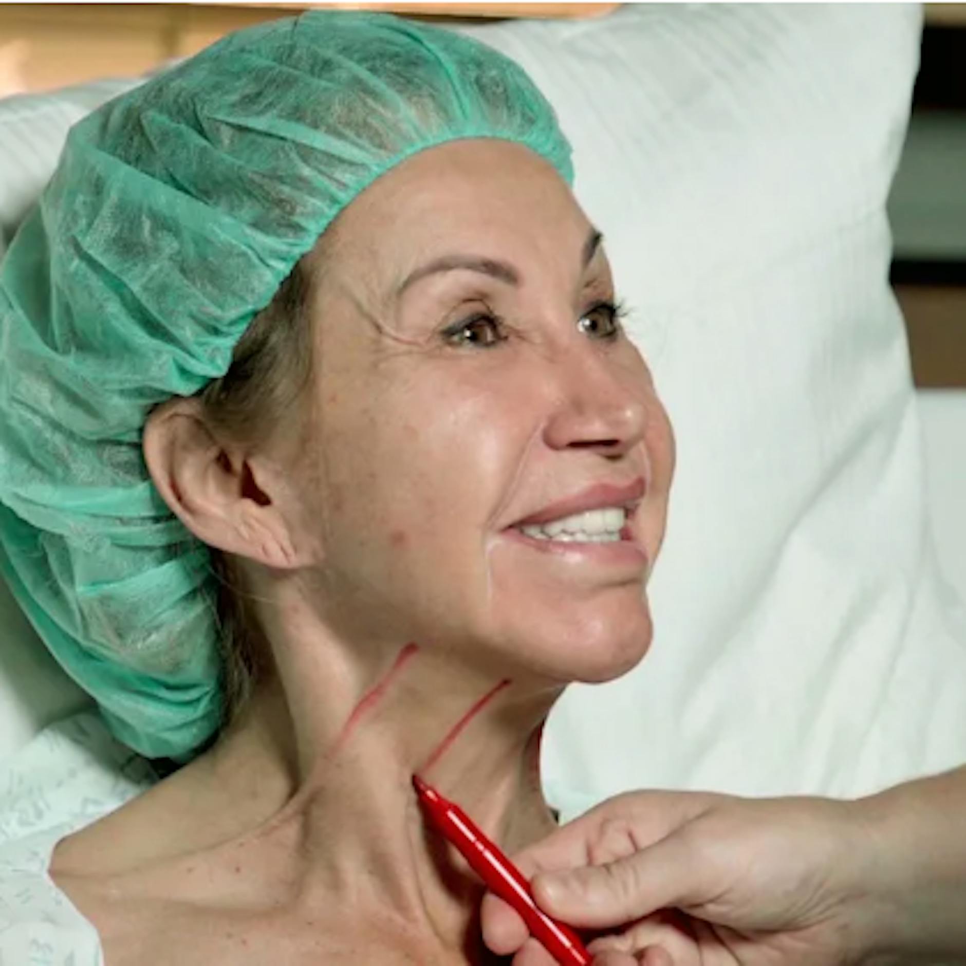 Mega-Schönheits-OP bei Carmen Geiss: DARAN schnippelten 3 Ärzte 8 Stunden lang