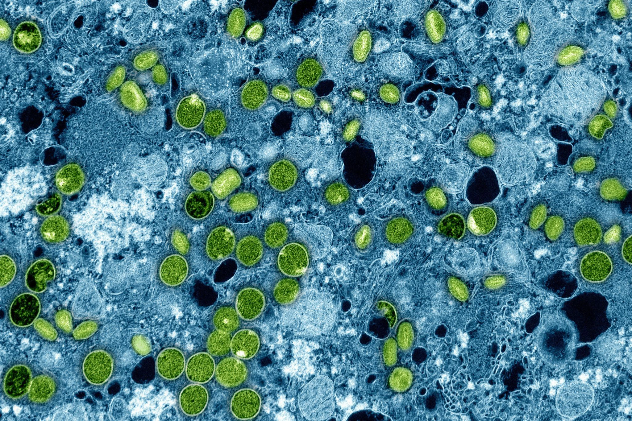 Diese kolorierte elektronenmikroskopische Aufnahme des National Institute of Allergy and Infectious Diseases aus dem Jahr 2024 zeigt Mpox-Viruspartikel (grün), die sich in infizierten kultivierten Zellen (blau) befinden. Die Viruspartikel befinden sich in verschiedenen Reifestadien, was zu Unterschieden in der Form führt.