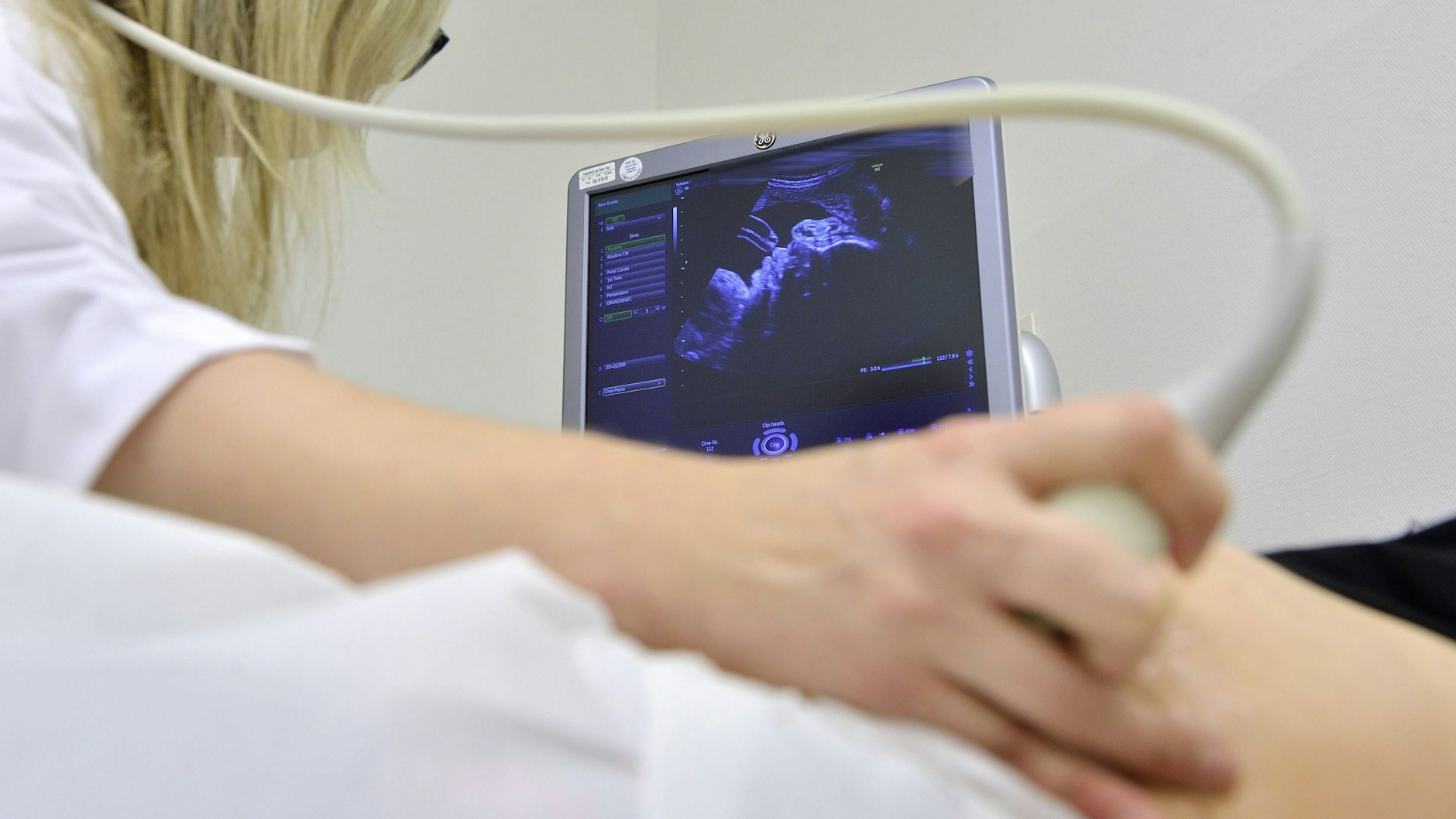 Die Scheitel-Steiß-Länge ist eine wichtige Kennzahl bei der Vermessung von Fötus oder Embryo während der Schwangerschaft.