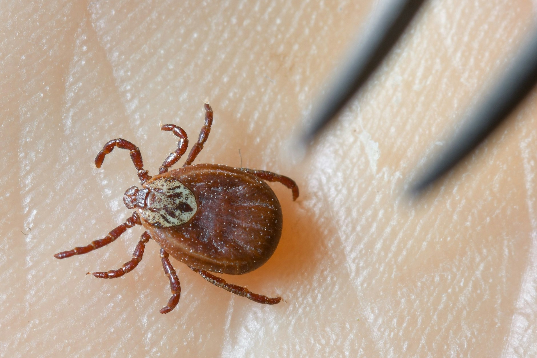 Eine Zecke sollte mit einer Pinzette entfernt werden. Ein Biss dieser Blutsauger kann gefährliche Folgen bei Menschen und auch Tieren haben.