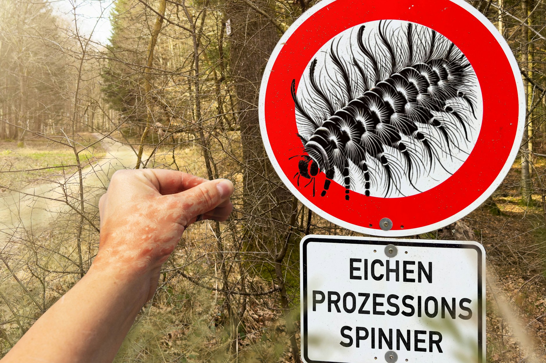 Die Brennhaare des Eichenprozessionsspinners können heftige Ausschläge auslösen - es droht sogar ein allergischer Schock! Die Giftraupen sind momentan auch in Berlin unterwegs.