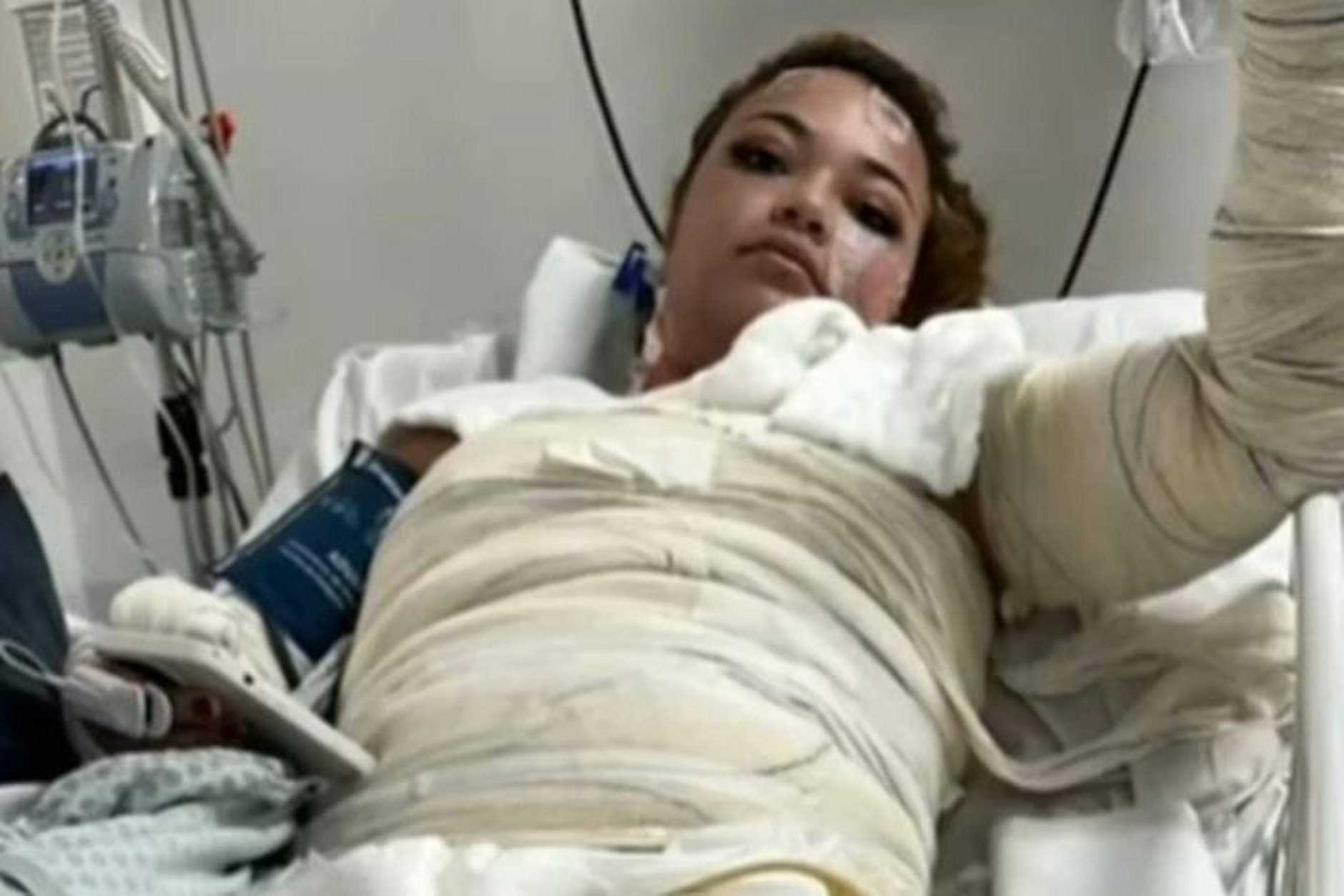 Die 24-jährige Brasilianerin Gabriele erlitt schwerste Verbrennungen am ganzen Körper. Nach einer Woche auf der Intensivstation starb die junge Mutter.