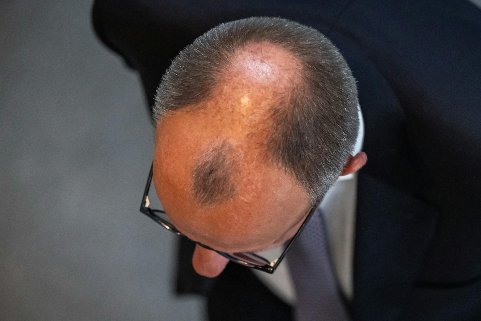 Die bekannteste Insel Deutschlands ist nicht Sylt, sondern die Haarinsel von Friedrich Merz.