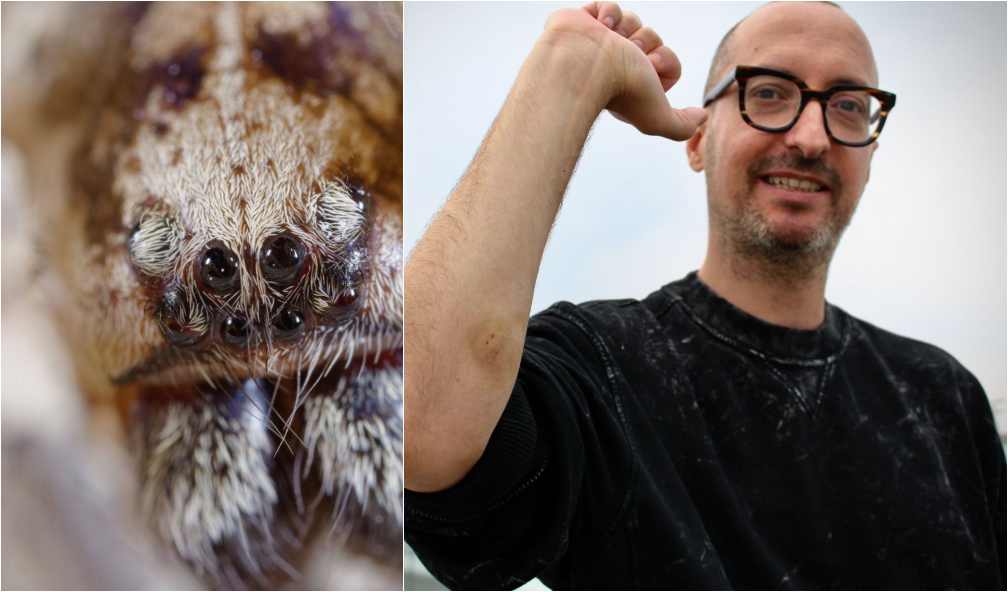 Ekel und brutale Schmerzen: Nosferatu-Spinne beißt KURIER-Mitarbeiter!