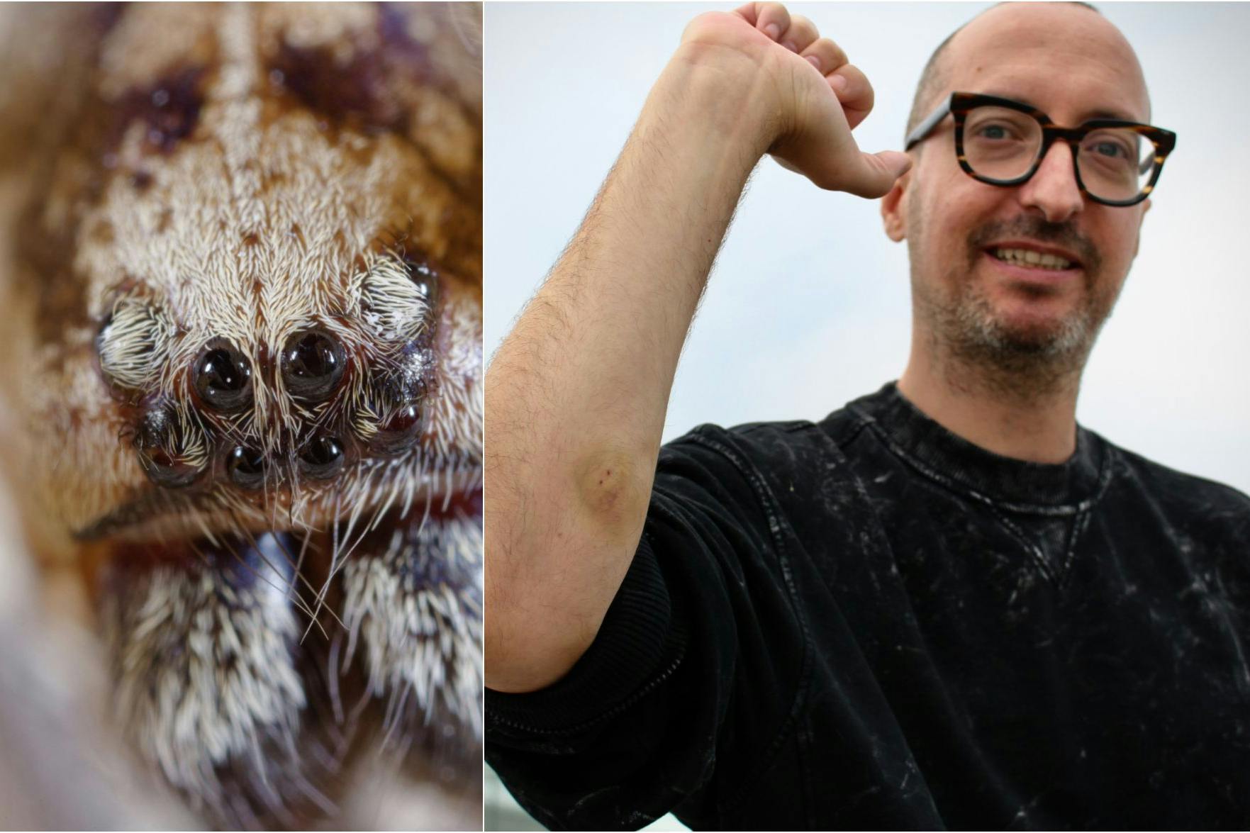 Was als entspannter Ausflug beginnt, endet mit einem Spinnenbiss: Mitten in Brandenburg schnappt eine Nosferatu-Spinne zu – ausgerechnet bei unserem KURIER-Kollegen Olli. Der Schmerz war höllisch.
