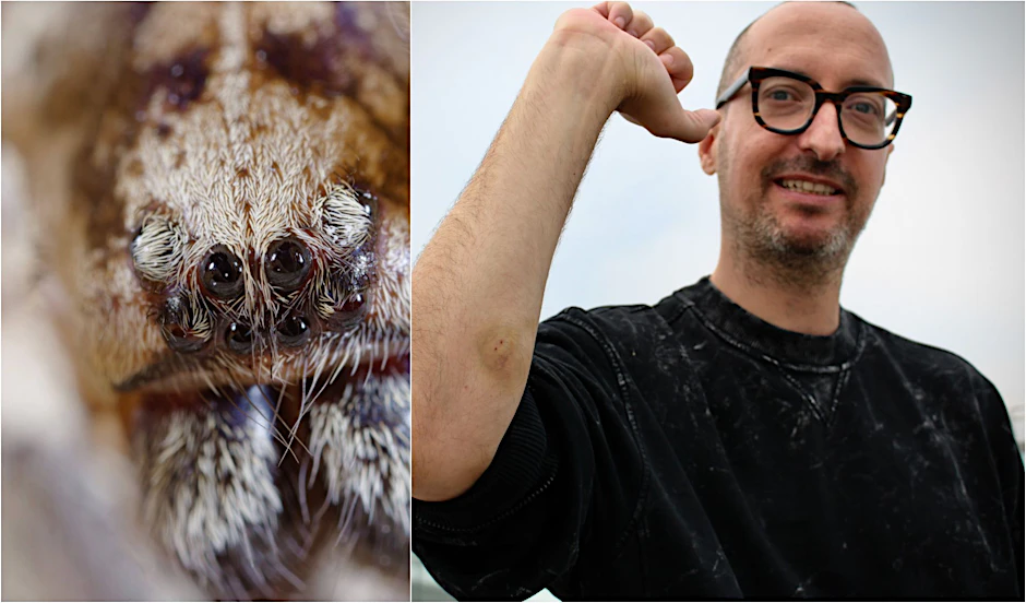 Was als entspannter Ausflug beginnt, endet mit einem Spinnenbiss: Mitten in Brandenburg schnappt eine Nosferatu-Spinne zu – ausgerechnet bei unserem KURIER-Kollegen Olli. Der Schmerz war höllisch.