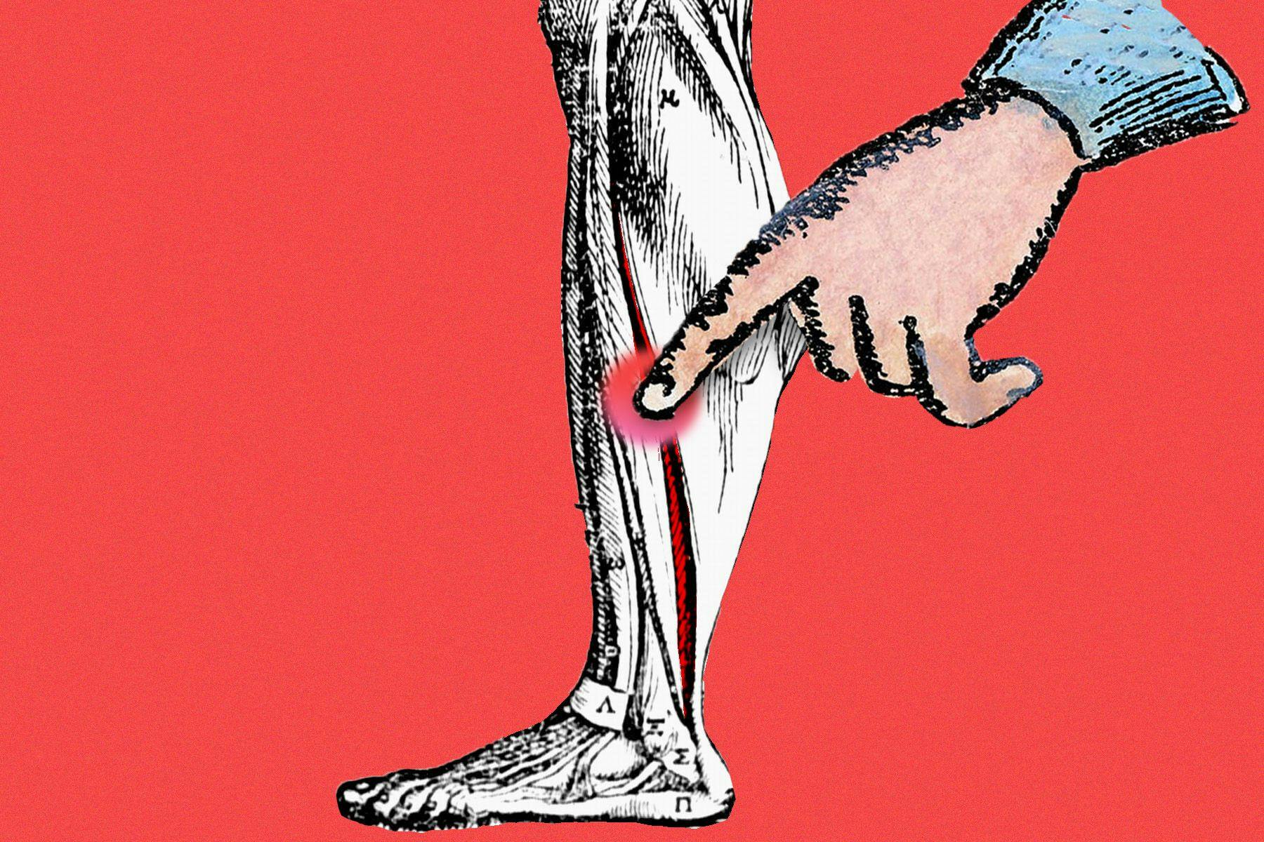 Thrombosen können quasi überall im Körper entstehen und gefährlich werden. Langes Sitzen kann die Entstehung eines Blutgerinnsels im Bein fördern.