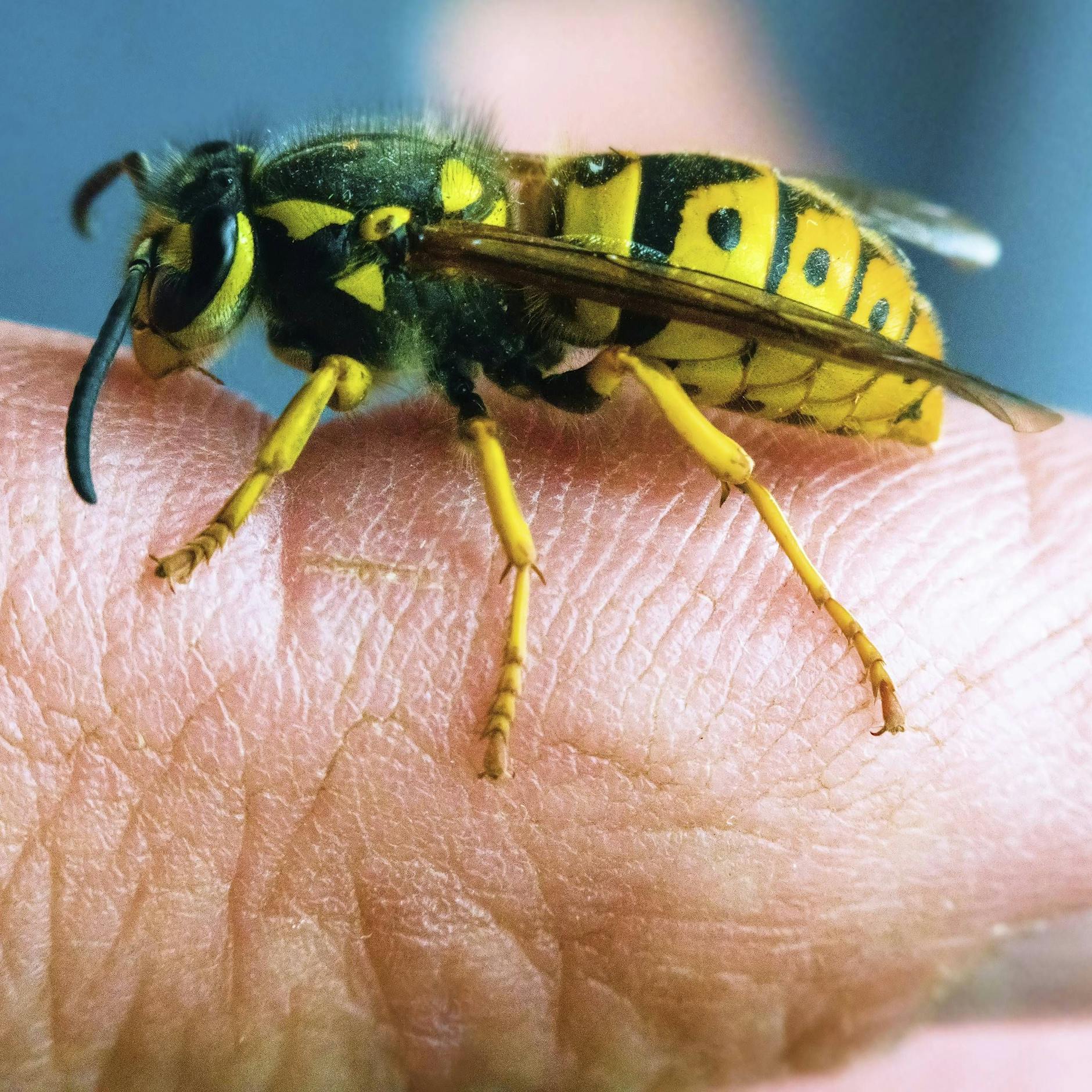 Junge Mutter über 100 Mal von Wespen gestochen! So fühlte es sich an