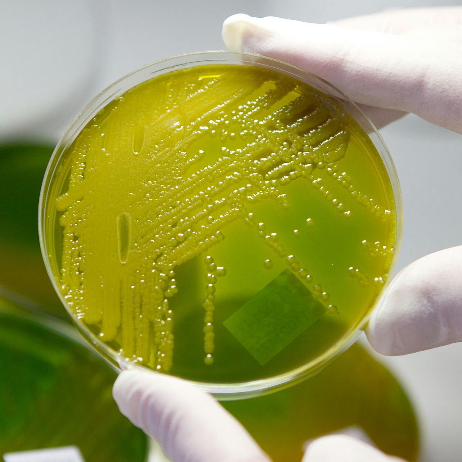 Ehec-Fälle in Berlin: Das sollte man über den Erreger jetzt wissen