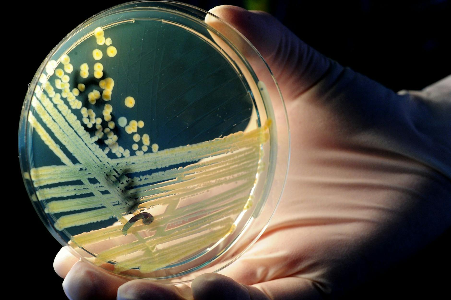 In Mecklenburg-Vorpommern haben sich mehrere Menschen mit dem Erreger Ehec infiziert.