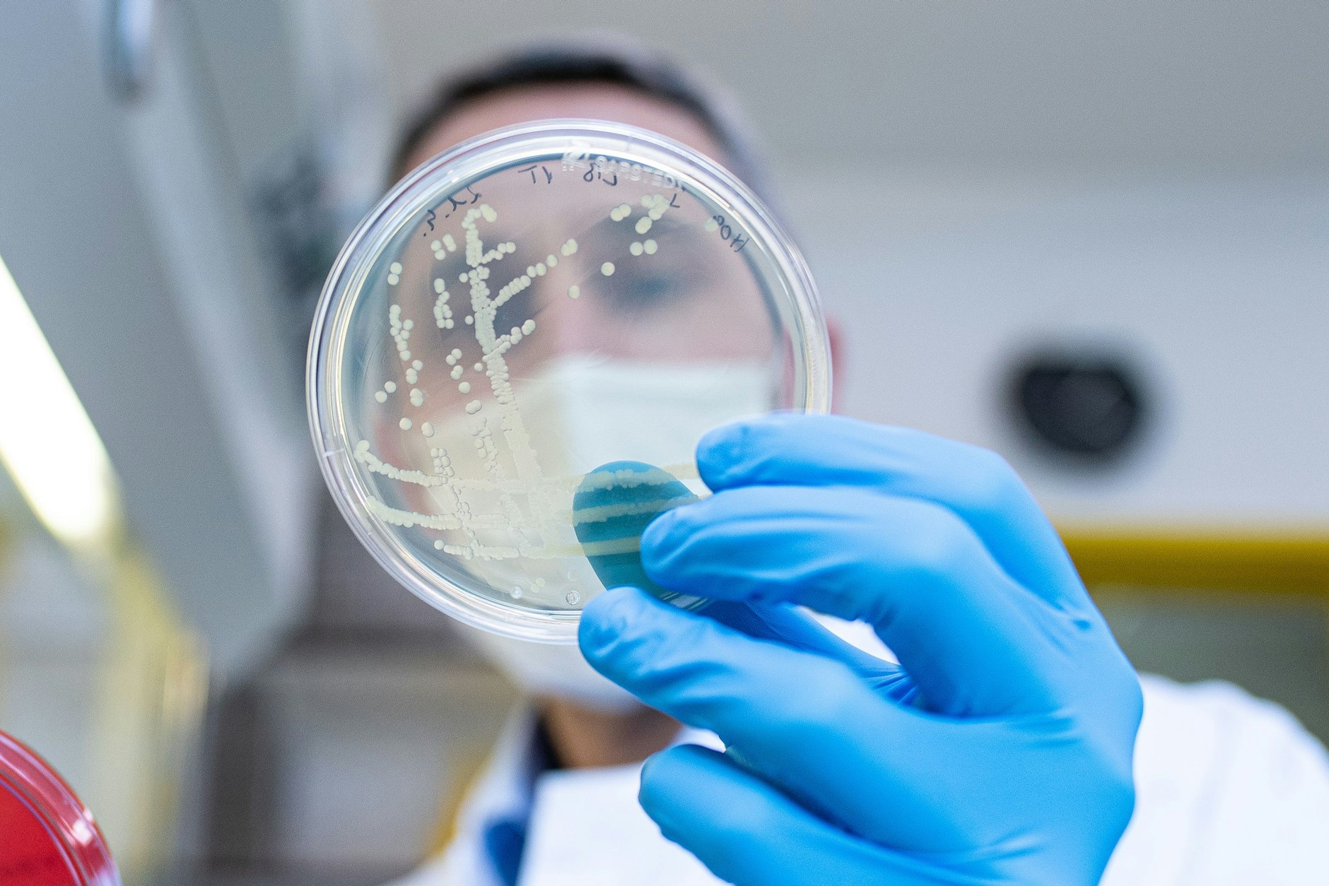 Der Ehec-Ausbruch in Mecklenburg-Vorpommern weitet sich aus: Schon sechs Kinder haben sich in Berlin mit dem Darmkeim angesteckt (Symbolfoto).