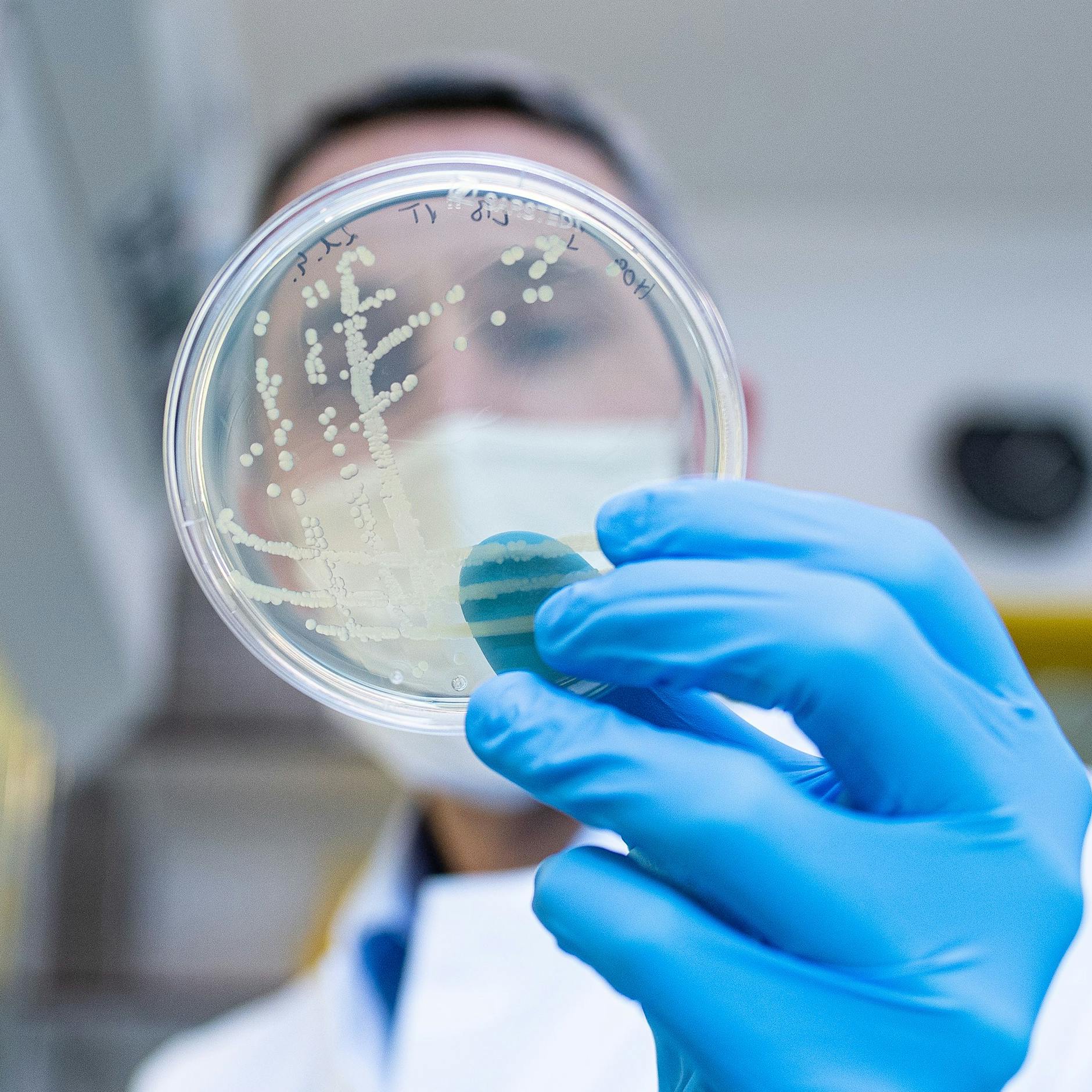 Ehec-Ausbruch in den Ferien: Schon sechs Berliner Kinder infiziert